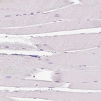 Immunohistochemical staining of human skeletal muscle shows no positivity in myocytes as expected.