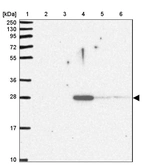 Lane 1: Marker [kDa] 250, 130, 95, 72, 55, 36, 28, 17, 10_br/_Lane 2: Human cell line RT-4_br/_Lane 3: Human cell line U-251MG sp_br/_Lane 4: Human plasma (IgG/HSA depleted)_br/_Lane 5: Human liver tissue_br/_Lane 6: Human tonsil tissue