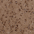 Anti-AK9 Antibody