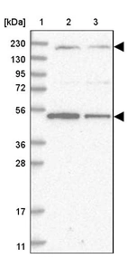 Lane 1: Marker [kDa] 230, 130, 95, 72, 56, 36, 28, 17, 11_br/_Lane 2: Human cell line RT-4_br/_Lane 3: Human cell line U-251MG sp
