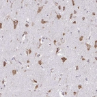 Immunohistochemical staining of human cerebral cortex shows strong cytoplasmic/membranous positivity in neurons.