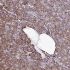 Immunohistochemical staining of human pancreas shows moderate cytoplasmic/membranous positivity in exocrine glandular cells.