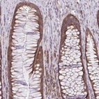 Immunohistochemical staining of human rectum shows moderate cytoplasmic/membranous positivity in glandular cells and lymphoid cells.
