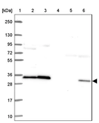 Lane 1: Marker [kDa] 250, 130, 95, 72, 55, 36, 28, 17, 10_br/_Lane 2: Human cell line RT-4_br/_Lane 3: Human cell line U-251 MG_br/_Lane 4: Human plasma_br/_Lane 5: Human Liver tissue_br/_Lane 6: Human Tonsil tissue