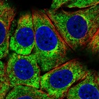 Immunofluorescent staining of human cell line MCF7 shows localization to cytosol & endoplasmic reticulum.