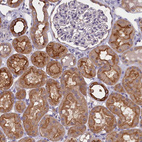 Immunohistochemical staining of human kidney shows strong cytoplasmic and membranous positivity in cells in tubules.