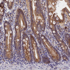 Immunohistochemical staining of human duodenum shows strong cytoplasmic positivity in glandular cells.