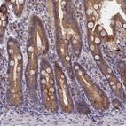Immunohistochemical staining of human duodenum shows strong cytoplasmic positivity in glandular cells.