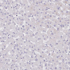 Immunohistochemical staining of human liver shows no positivity in hepatocytes as expected.