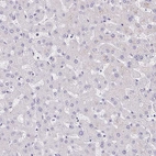 Immunohistochemical staining of human liver shows no positivity in hepatocytes as expected.