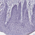 Immunohistochemical staining of human skin shows no positivity in squamous epithelial cells as expected.