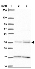 Lane 1: Marker [kDa] 250, 130, 95, 72, 55, 36, 28, 17, 10_br/_Lane 2: Human cell line RT-4_br/_Lane 3: Human cell line U-251 MG