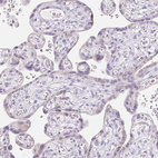 Anti-CLDN16 Antibody