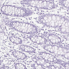 Immunohistochemical staining of human colon shows no positivity in glandular cells as expected.
