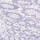 Immunohistochemical staining of human colon shows no positivity in glandular cells as expected.