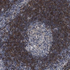 Immunohistochemical staining of human lymph node shows strong cytoplasmic positivity in non-germinal center cells.