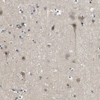 Immunohistochemical staining of human cerebral cortex shows moderate cytoplasmic positivity in neurons.
