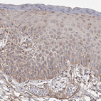 Anti-DHRS9 Antibody