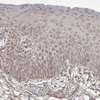 Immunohistochemical staining of human skin shows moderate cytoplasmic positivity in squamous epithelial cells.