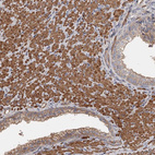 Immunohistochemical staining of human prostate shows strong cytoplasmic positivity in smooth muscle cells.
