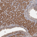 Anti-DHRS9 Antibody