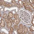 Immunohistochemical staining of human kidney shows strong cytoplasmic positivity in cells in tubules.