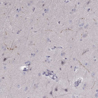 Immunohistochemical staining of human cerebral cortex shows strong cytoplasmic positivity in subset of neuropil.