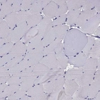 Immunohistochemical staining of human skeletal muscle shows no positivity in myocytes as expected.