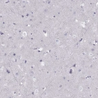 Immunohistochemical staining of human cerebral cortex shows no positivity in neurons as expected.
