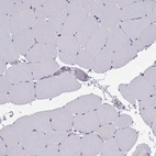 Immunohistochemical staining of human skeletal muscle shows no positivity in myocytes as expected.