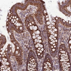 Immunohistochemical staining of human colon shows strong positivity in cytoplasm granular in glandular cells.