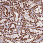 Anti-HECTD4 Antibody