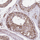 Immunohistochemical staining of human testis shows strong positivity in cytoplasm granular in cells in seminiferous ducts and leydig cells.