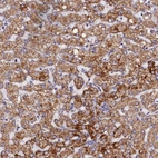 Immunohistochemical staining of human liver shows strong positivity in cytoplasm granular in hepatocytes.