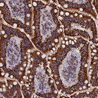 Immunohistochemical staining of human duodenum shows strong positivity in cytoplasm granular in glandular cells.