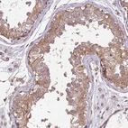 Immunohistochemical staining of human testis shows moderate cytoplasmic positivity in cells in seminiferous ducts.