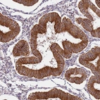 Immunohistochemical staining of human endometrium shows strong cytoplasmic positivity in glandular cells.