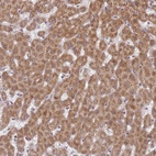Immunohistochemical staining of human liver shows strong cytoplasmic positivity in hepatocytes.