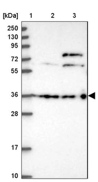 Lane 1: Marker [kDa] 250, 130, 95, 72, 55, 36, 28, 17, 10_br/_Lane 2: Human cell line RT-4_br/_Lane 3: Human cell line U-251MG sp