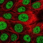 Immunofluorescent staining of human cell line MCF7 shows localization to nucleoplasm.