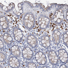 Immunohistochemical staining of human colon shows strong cytoplasmic positivity in lymphoid cells.