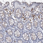 Immunohistochemical staining of human colon shows strong cytoplasmic positivity in lymphoid cells.