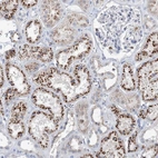 Immunohistochemical staining of human kidney shows strong cytoplasmic granular positivity in cells in tubules.