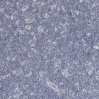Immunohistochemical staining of human lymph node shows no positivity in non-germinal center cells as expected.