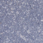 Immunohistochemical staining of human lymph node shows no positivity in non-germinal center cells as expected.