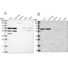 Western blot analysis using Anti-SIAE antibody HPA038053 (A) shows similar pattern to independent antibody HPA038052 (B).