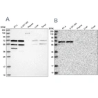 Western blot analysis using Anti-SIAE antibody HPA038053 (A) shows similar pattern to independent antibody HPA038052 (B).