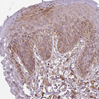 Immunohistochemical staining of human skin shows moderate cytoplasmic-membranous positivity in squamous epithelial cells.