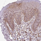 Immunohistochemical staining of human skin shows moderate cytoplasmic-membranous positivity in squamous epithelial cells.