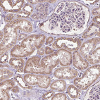 Immunohistochemical staining of human kidney shows moderate cytoplasmic positivity in cells in tubules.
